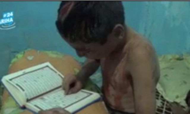 فيديو مبكى.. طفل سورى رغم إصابته فى القصف ينشغل بترتيل ورده اليومي من القرآن الكريم