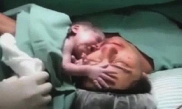 فيديو معجزة.. رضيع يبكي ويرفض ترك أمه بعد الولادة