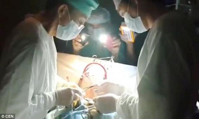 انقطعت الكهرباء فأكمل الأطباء عملية قلب مفتوح بكشاف الموبايل