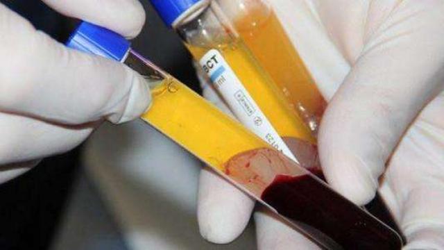 تعرف على آخر تطورات العلاج بـ”بلازما الدم” في مصر