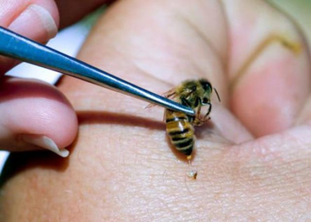 العلاج بقرص النحل