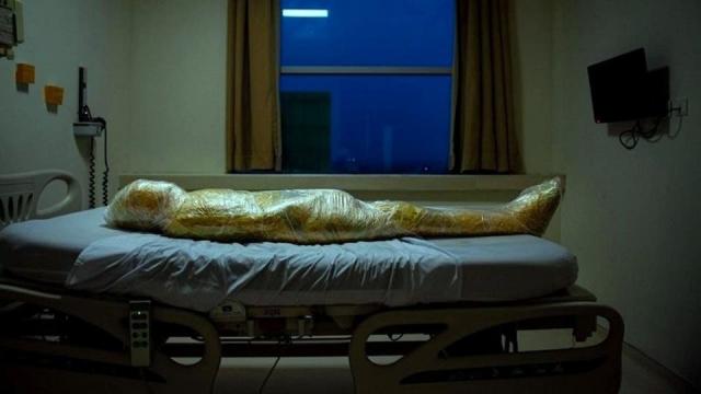 عاجل وخطير ..صورة لجثة مصابة بكورونا تثير الذعر فى العالم