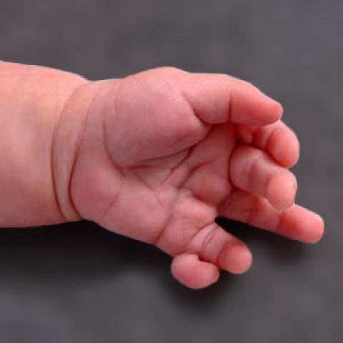 ما حكم بتر الأصبع الزائد لطفل حديث الولادة؟