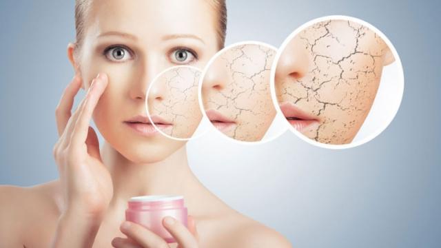 ما هي طرق حماية الجلد من الجفاف في الشتاء؟.. إليك الإجابة