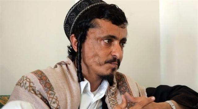 أمريكا تتحرك لإنقاذ يهودي يمني محبوس عند الحوثيين من 4 سنوات