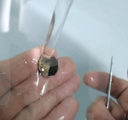  جراحة عاجلة لاستخراج عملة معدنية من أنف رجل 