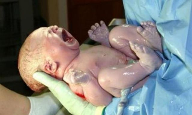 دراسة: الولادة القيصرية تهدد الأطفال بالربو