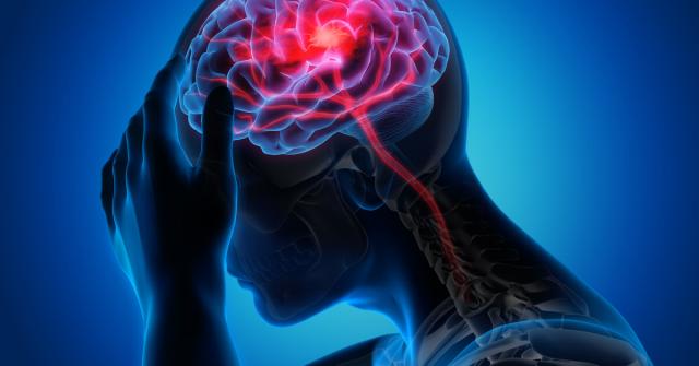 طرق سهلة للتقليل من خطر الإصابة بالسكتة الدماغية
