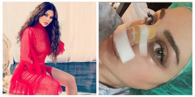 أول صور لإبنة هيفاء وهبي بعد تشوه أنفها بسبب عمليات التجميل