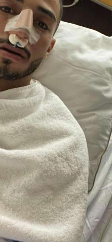 محمد عبد المنعم يجرى جراحة الأنف بعد إصابته أمام السنغال