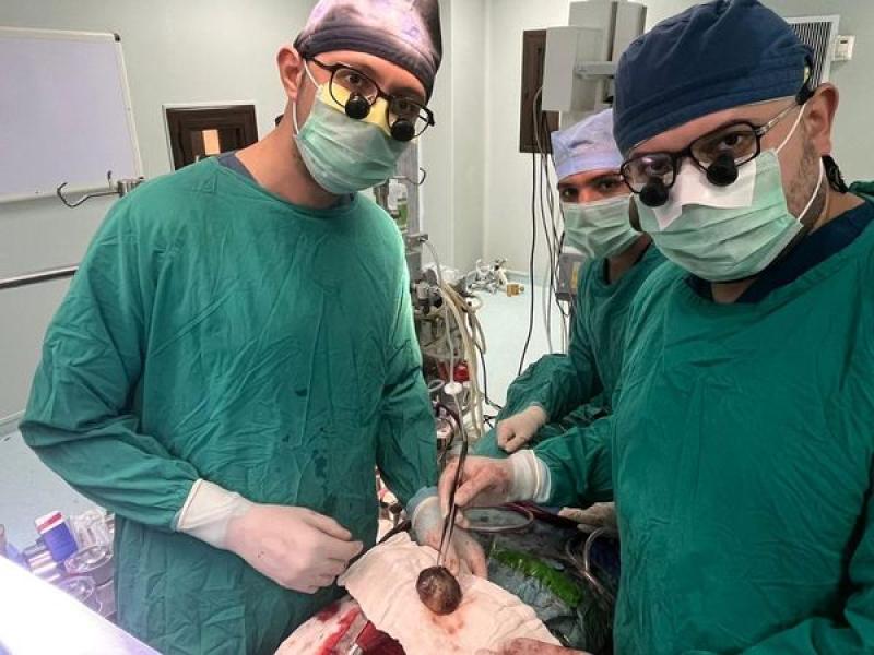 بالصور..فريق طبى بجامعة أسيوط ينجح فى إنقاذ  حياة سيدة أربعينية باستئصال ورم ضخم من القلب
