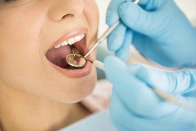 ما هي تركيبات الاسنان - وكم تكلفتها