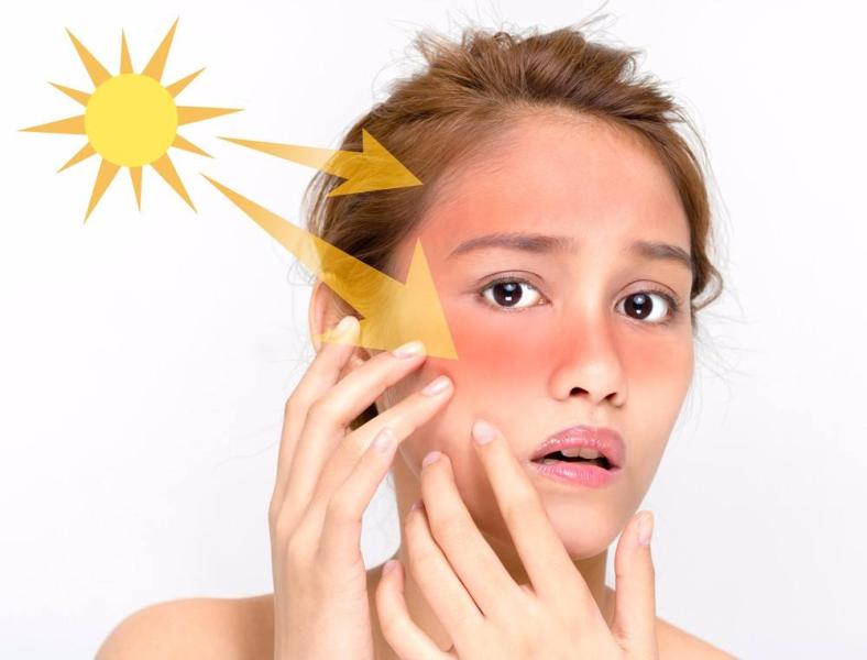 5 نصائح ضرورية للحفاظ على البشرة من أشعة الشمس في الصيف
