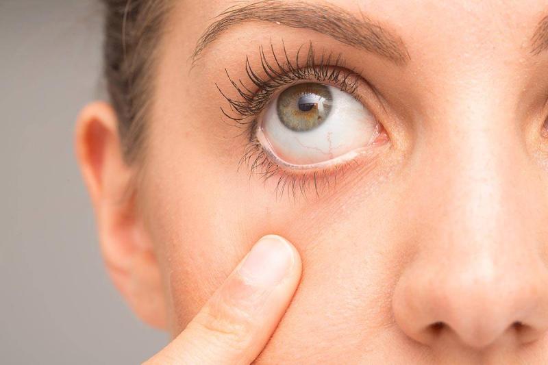 5 نصائح فعالة لتفادي جفاف العين في فصل الصيف