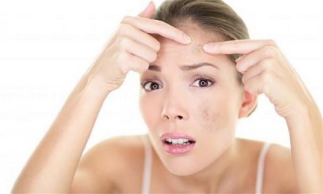 10 وصفات طبيعية لإزالة البقع الداكنة على الجلد