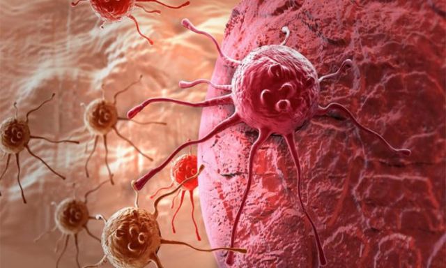 مفاجأة.. دراسة حديثة لـ”مرضى السرطان”: لا تقبل العلاج الكيميائى لأنه سيقتلك
