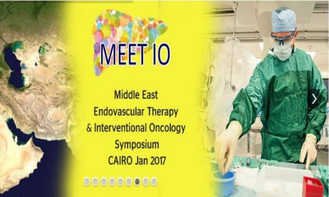 القاهرة تستضيف مؤتمر عالمي  لعلاج الأورام السرطانية والأوعية الدموية بالأشعة التداخلية..الأربعاء