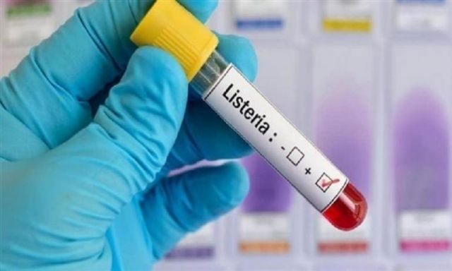 وزارة الصحة الإسبانية تحذر من تفشي داء الليستيريا
